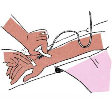 Someone attaching a drip to a hand.